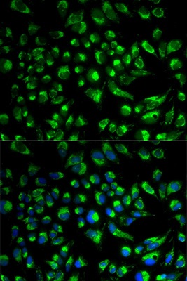 Immunocytochemistry/ Immunofluorescence - Anti-SPAM1 antibody (AB196596)