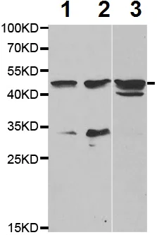 Western blot - Anti-SPAM1 antibody (AB196596)