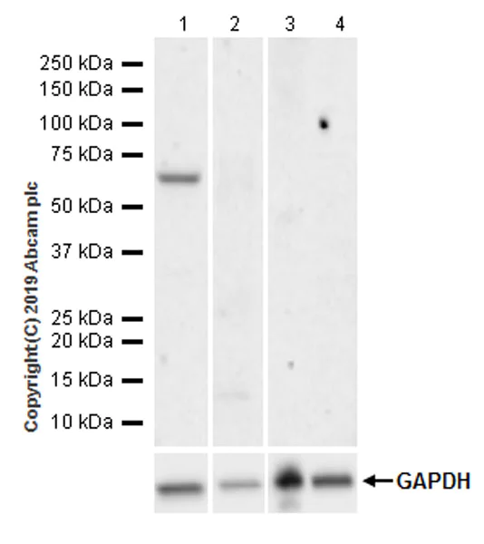 Western blot - Anti-SPAM1 antibody [EPR22906-57] (AB231771)