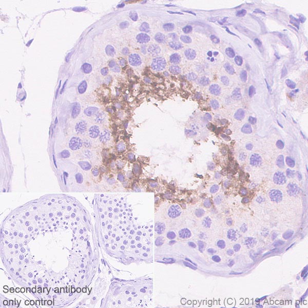 Immunohistochemistry (Formalin/PFA-fixed paraffin-embedded sections) - Anti-SPAM1 antibody [EPR22906-57] - BSA and Azide free (AB256482), expandable thumbnail