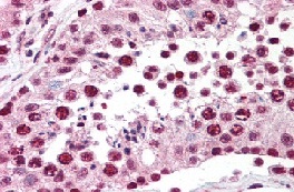 Immunohistochemistry (Formalin/PFA-fixed paraffin-embedded sections) - Anti-SPANX antibody (AB119280)
