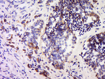 Immunohistochemistry (Formalin/PFA-fixed paraffin-embedded sections) - Anti-SPARC antibody (AB203284)