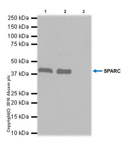 Immunoprecipitation - Anti-SPARC antibody [EPR20121] - Low endotoxin, Azide free (AB223156), expandable thumbnail