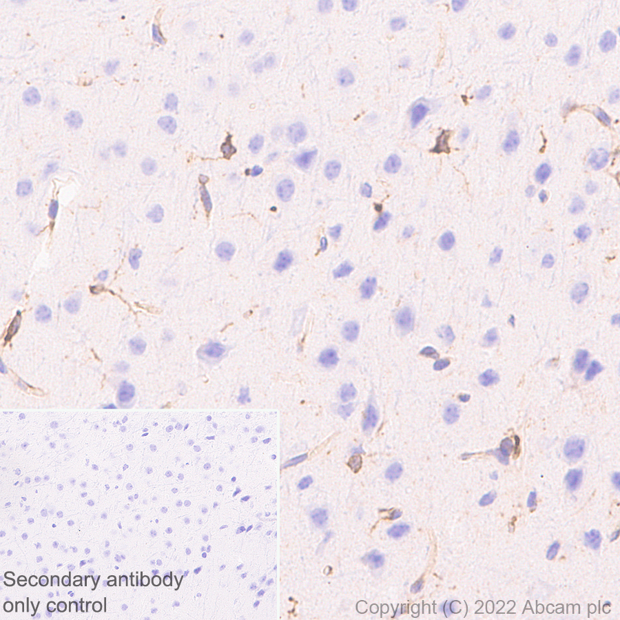 Immunohistochemistry (Formalin/PFA-fixed paraffin-embedded sections) - Anti-SPARC antibody [EPR25122-122] - BSA and Azide free (ab290647), expandable thumbnail