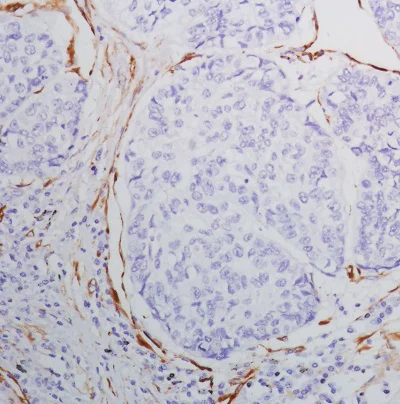 Immunohistochemistry (Formalin/PFA-fixed paraffin-embedded sections) - Anti-SPARC antibody [SP205] (AB225716)
