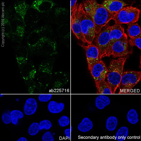 Immunocytochemistry/ Immunofluorescence - Anti-SPARC antibody [SP205] - BSA and Azide free (AB245733)