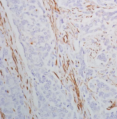 Immunohistochemistry (Formalin/PFA-fixed paraffin-embedded sections) - Anti-SPARC antibody [SP205] - BSA and Azide free (AB245733)