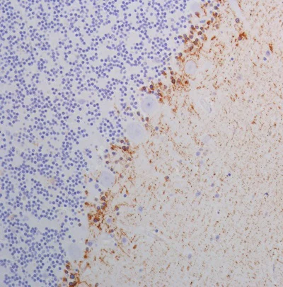Immunohistochemistry (Formalin/PFA-fixed paraffin-embedded sections) - Anti-SPARC antibody [SP205] - BSA and Azide free (AB245733)