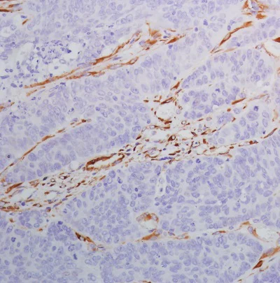 Immunohistochemistry (Formalin/PFA-fixed paraffin-embedded sections) - Anti-SPARC antibody [SP205] - BSA and Azide free (AB245733)