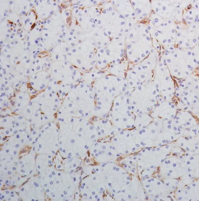 Immunohistochemistry (Formalin/PFA-fixed paraffin-embedded sections) - Anti-SPARC antibody [SP205] - BSA and Azide free (AB245733)