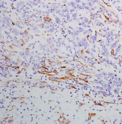 Immunohistochemistry (Formalin/PFA-fixed paraffin-embedded sections) - Anti-SPARC antibody [SP205] - BSA and Azide free (AB245733)