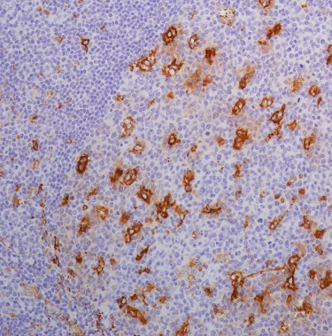 Immunohistochemistry (Formalin/PFA-fixed paraffin-embedded sections) - Anti-SPARC antibody [SP205] - BSA and Azide free (AB245733)