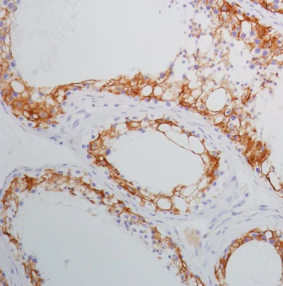 Immunohistochemistry (Formalin/PFA-fixed paraffin-embedded sections) - Anti-SPARC antibody [SP205] - BSA and Azide free (AB245733)