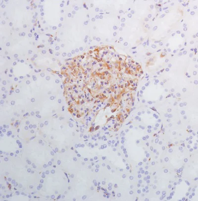 Immunohistochemistry (Formalin/PFA-fixed paraffin-embedded sections) - Anti-SPARC antibody [SP205] - BSA and Azide free (AB245733)