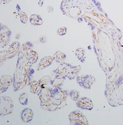 Immunohistochemistry (Formalin/PFA-fixed paraffin-embedded sections) - Anti-SPARC antibody [SP205] - BSA and Azide free (AB245733)