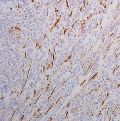 Immunohistochemistry (Formalin/PFA-fixed paraffin-embedded sections) - Anti-SPARC antibody [SP205] - BSA and Azide free (AB245733)