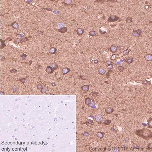 Immunohistochemistry (Formalin/PFA-fixed paraffin-embedded sections) - Anti-SPARCL1 antibody [EPR22615-277] - BSA and Azide free (AB256506)