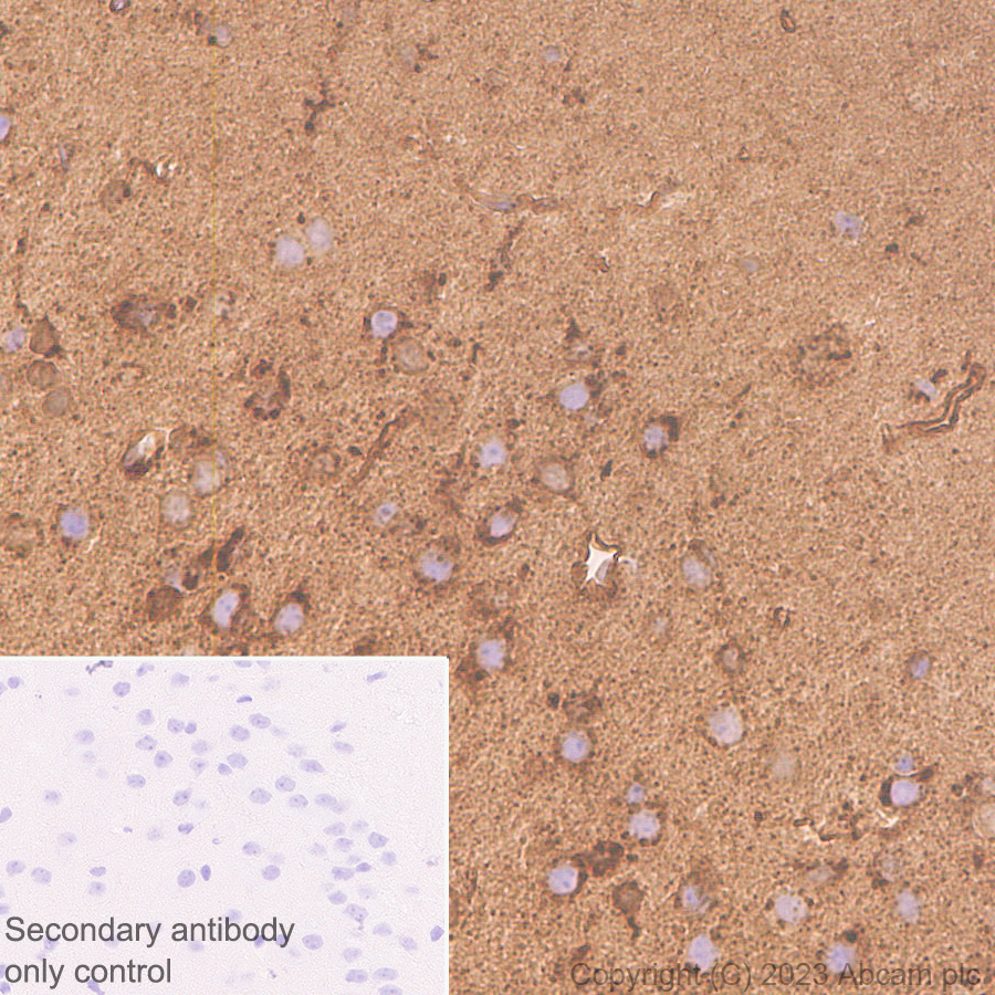 Immunohistochemistry (Formalin/PFA-fixed paraffin-embedded sections) - Anti-SPARCL1 antibody [EPR28135-54] (ab313638), expandable thumbnail