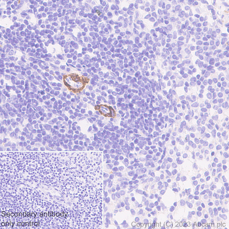 Immunohistochemistry (Formalin/PFA-fixed paraffin-embedded sections) - Anti-SPARCL1 antibody [EPR28135-54] (AB313638), expandable thumbnail