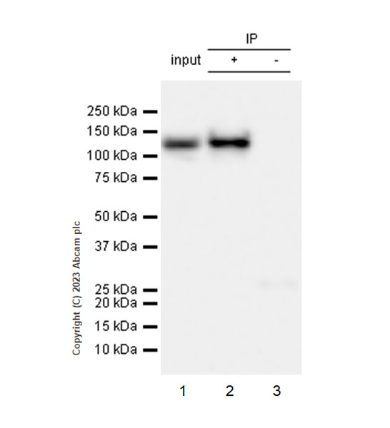 Immunoprecipitation - Anti-SPARCL1 antibody [EPR28135-54] (AB313638), expandable thumbnail