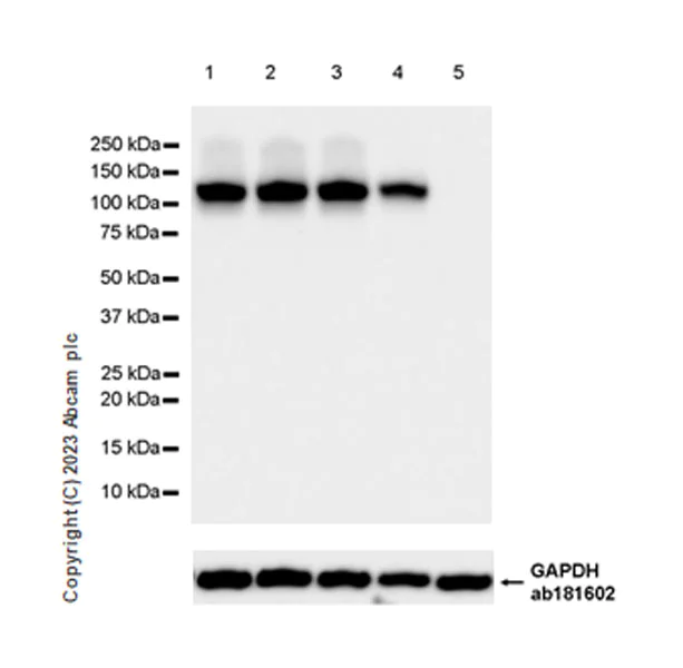 Western blot - Anti-SPARCL1 antibody [EPR28135-54] (AB313638)