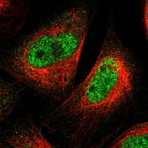 Immunocytochemistry/ Immunofluorescence - Anti-Spartan antibody (AB121853)