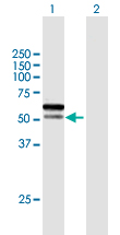 Western blot - Anti-Spartan antibody (AB167190)