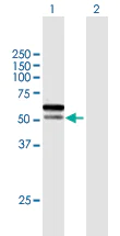 Western blot - Anti-Spartan antibody (AB167190)