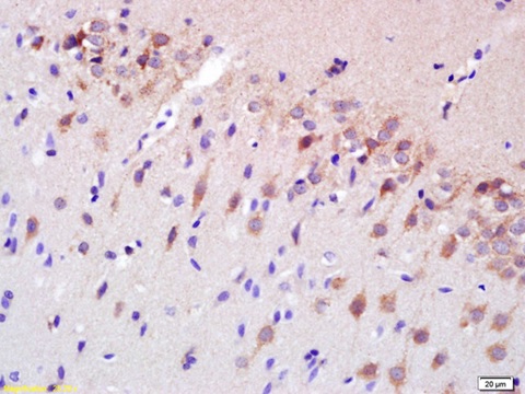 Immunohistochemistry (Formalin/PFA-fixed paraffin-embedded sections) - Anti-Spastin antibody (AB214301)
