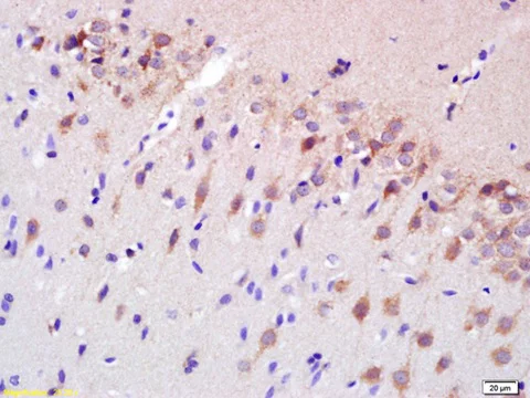 Immunohistochemistry (Formalin/PFA-fixed paraffin-embedded sections) - Anti-Spastin antibody (AB214301)