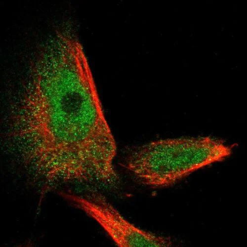 Immunocytochemistry/ Immunofluorescence - Anti-Spastin antibody (AB244354)