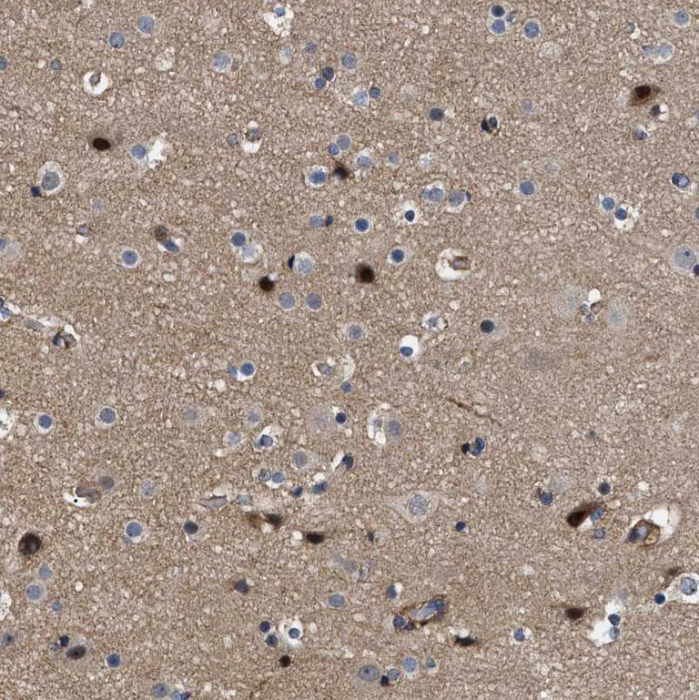 Immunohistochemistry (Formalin/PFA-fixed paraffin-embedded sections) - Anti-Spastin antibody (AB244354)