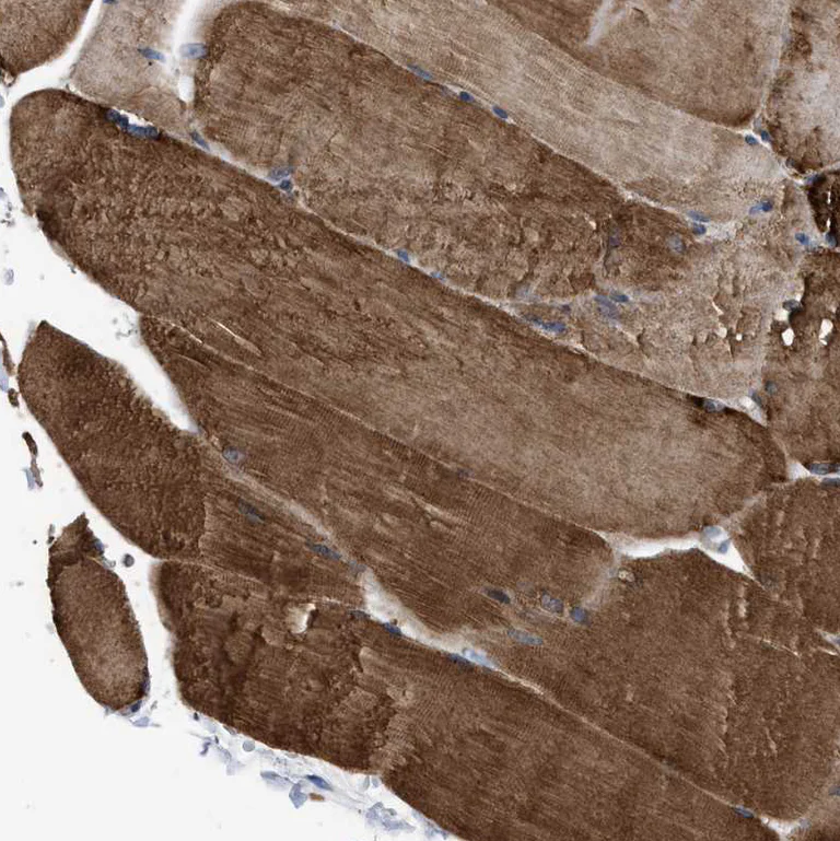 Immunohistochemistry (Formalin/PFA-fixed paraffin-embedded sections) - Anti-Spastin antibody (AB244354)