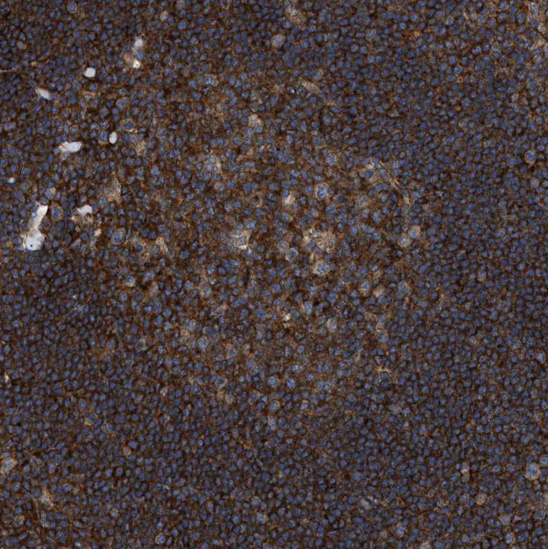 Immunohistochemistry (Formalin/PFA-fixed paraffin-embedded sections) - Anti-Spastin antibody (AB244354)