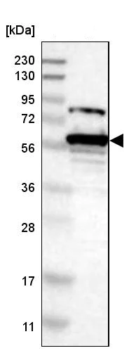 Western blot - Anti-Spastin antibody (AB244354)