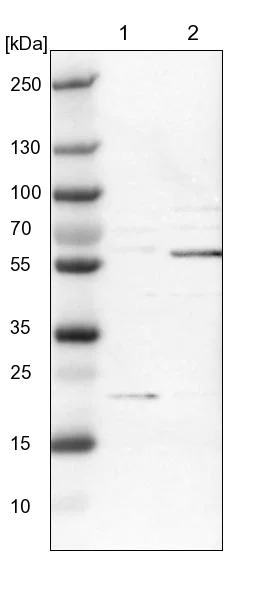 Western blot - Anti-Spastin antibody (AB244354)
