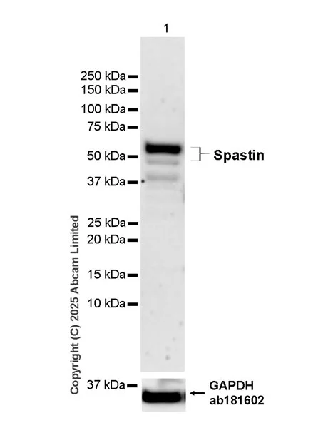 Western blot - Anti-Spastin antibody [EPR29584-166] (AB325650)