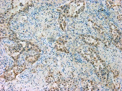 Immunohistochemistry (Formalin/PFA-fixed paraffin-embedded sections) - Anti-Spastin antibody [Sp 3G11/1] (AB31850)