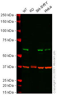 Western blot - Anti-Spastin antibody [Sp 3G11/1] (AB31850)