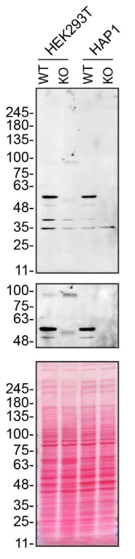 Western blot - Anti-Spastin antibody [Sp 3G11/1] (AB31850)