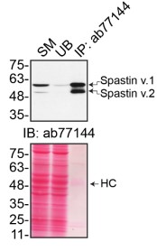 Immunoprecipitation - Anti-Spastin antibody [Sp 6C6] (AB77144)