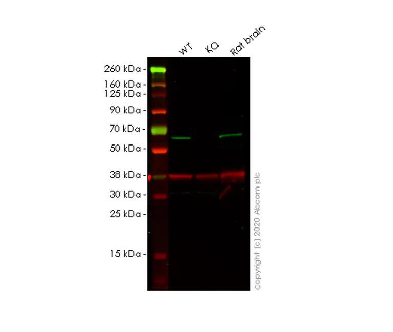 Western blot - Anti-Spastin antibody [Sp 6C6] (AB77144)
