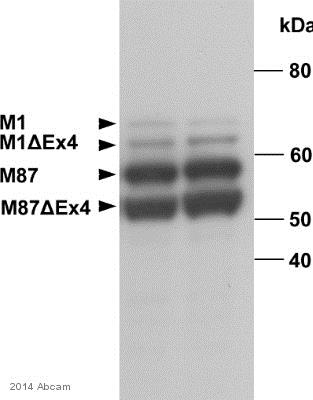 Western blot - Anti-Spastin antibody [Sp 6C6] (AB77144)