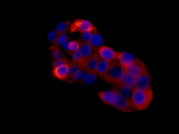 Immunocytochemistry/ Immunofluorescence - Anti-Spata18 antibody [EPR13704] (AB180154)