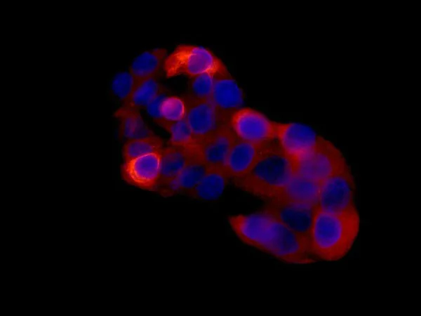 Immunocytochemistry/ Immunofluorescence - Anti-Spata18 antibody [EPR13704] (AB180154)