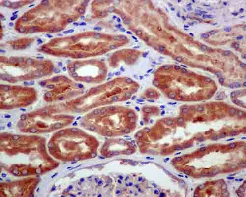 Immunohistochemistry (Formalin/PFA-fixed paraffin-embedded sections) - Anti-Spata18 antibody [EPR13704] (AB180154)