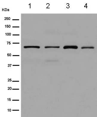 Western blot - Anti-Spata18 antibody [EPR13704] (AB180154)