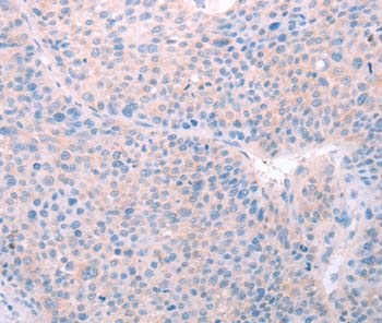 Immunohistochemistry (Formalin/PFA-fixed paraffin-embedded sections) - Anti-SPATA6 antibody (AB197680), expandable thumbnail