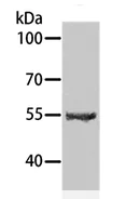 Western blot - Anti-SPATA6 antibody (AB197680)