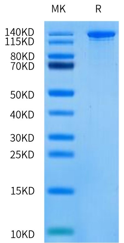 SDS-PAGE - SpCas9 D10A Nickase (Active) (AB316172), expandable thumbnail